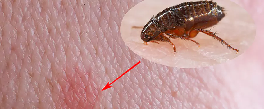 Flea Control for Humans Colleyville, TX